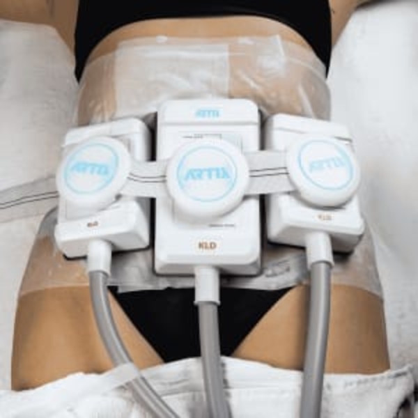 Criolipolise de Placas