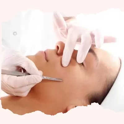 Dermaplaning